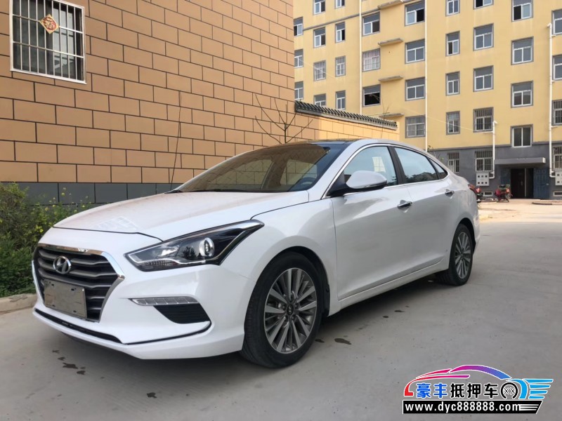 17年现代名图小型车 [在售]